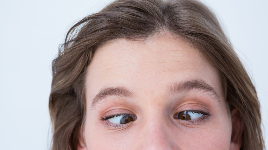 En skelning innebär att ögonen inte tittar åt samma håll. Foto: Shutterstock